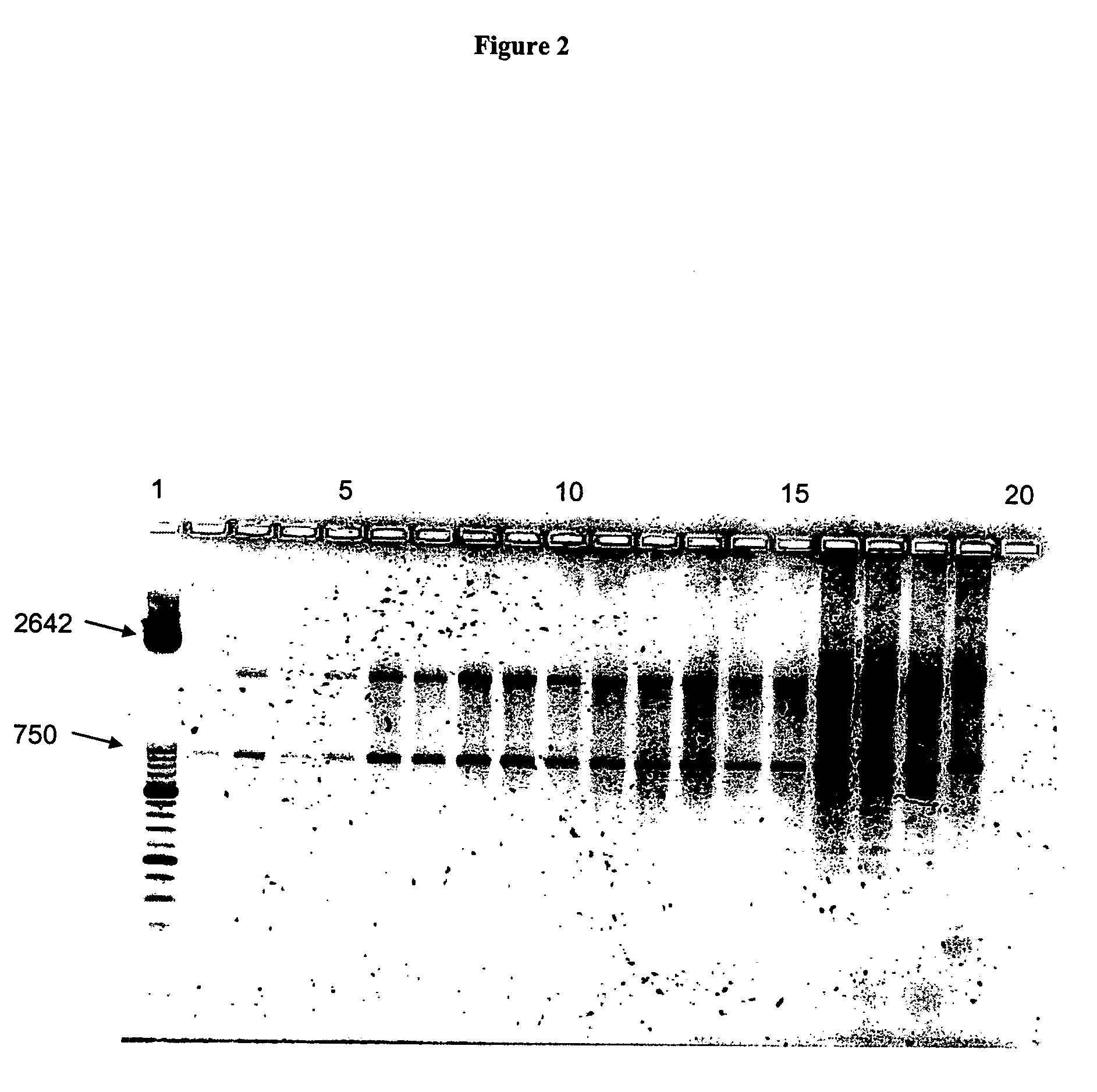 Nucleic acid preparation from whole blood for use in diagnosis of transmissible spongiform encephalopathy