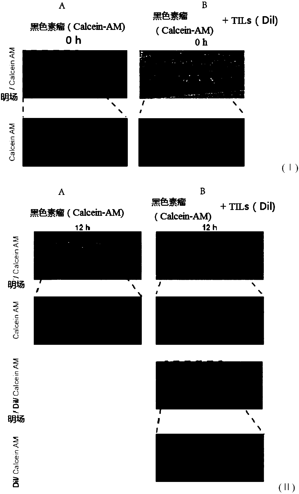 Immune cell tumor killing capability detection model and construction method and application thereof