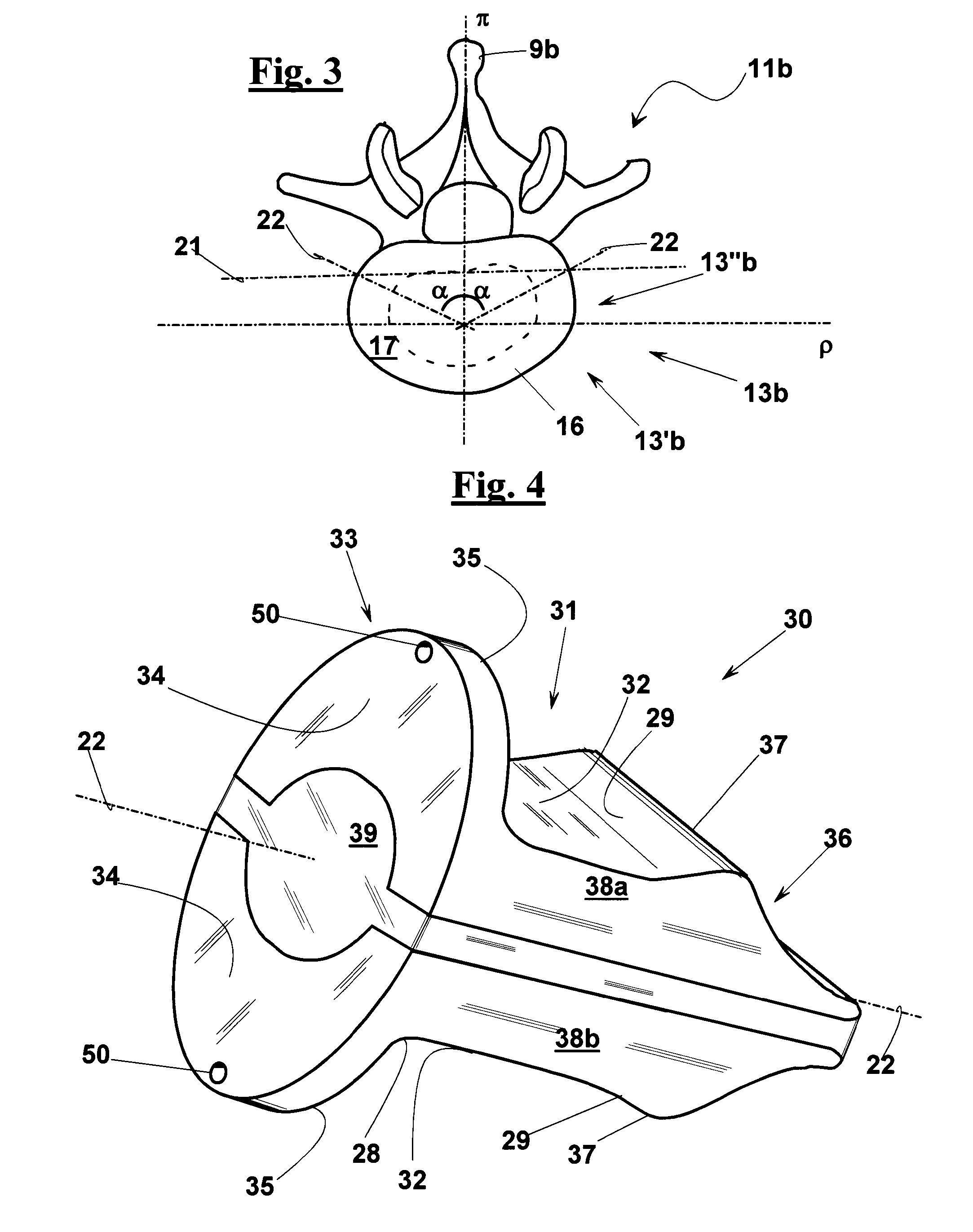 Intervertebral support