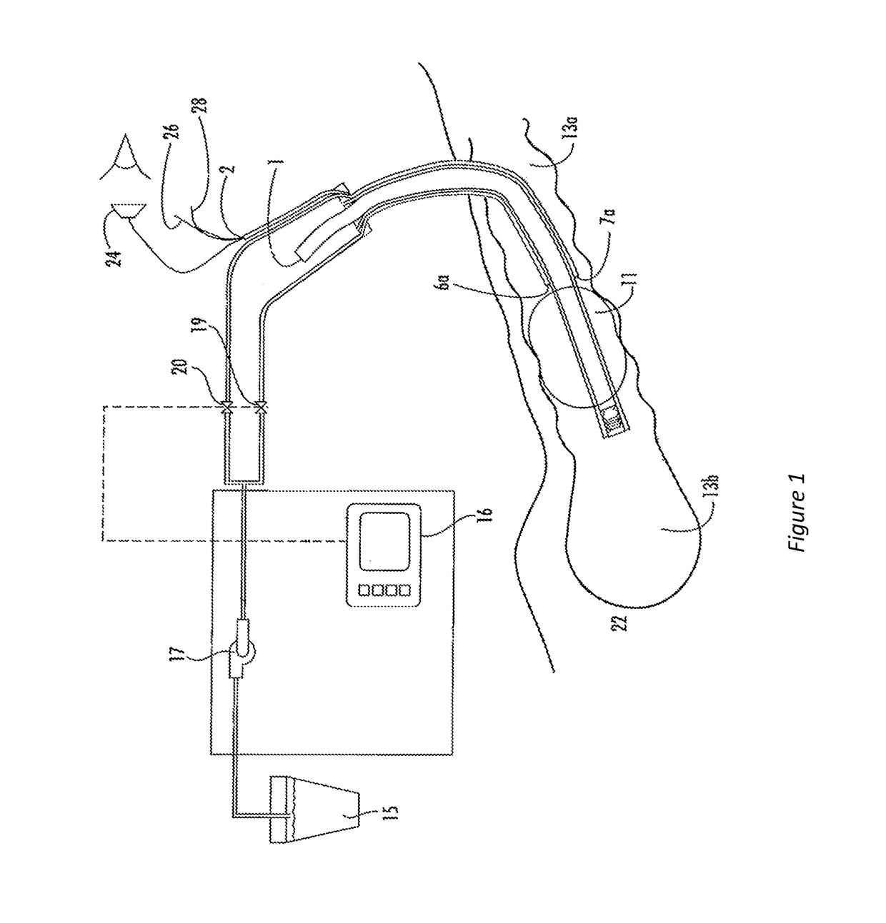 Non-invasive method of diagnosing dysphagia in patients having a tracheostomy