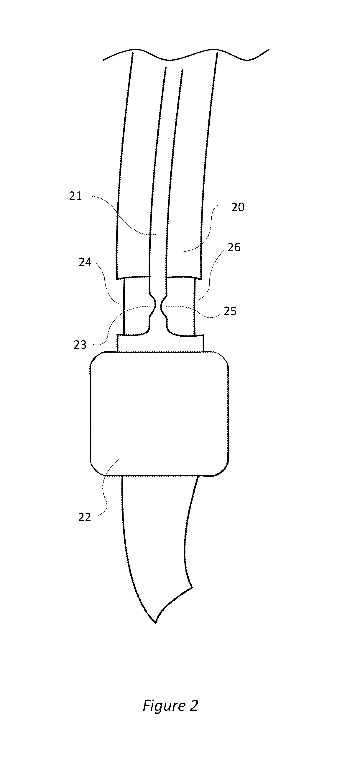 Non-invasive method of diagnosing dysphagia in patients having a tracheostomy