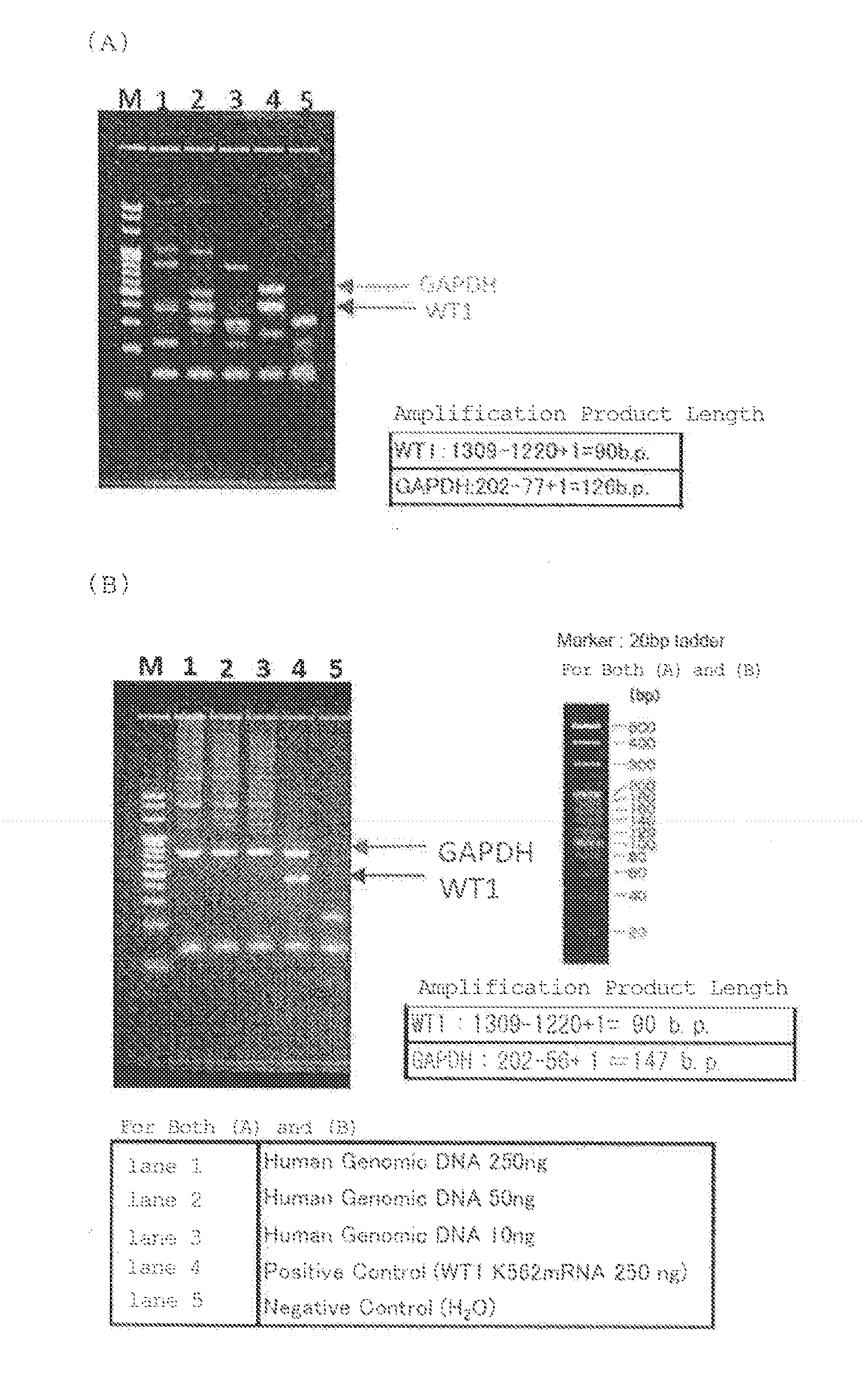 QUANTIFICATION METHOD FOR EXPRESSION LEVEL OF WT1 mRNA