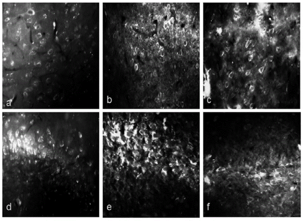 Application of SB202190 in preparation of medicines for treating intractable epilepsy