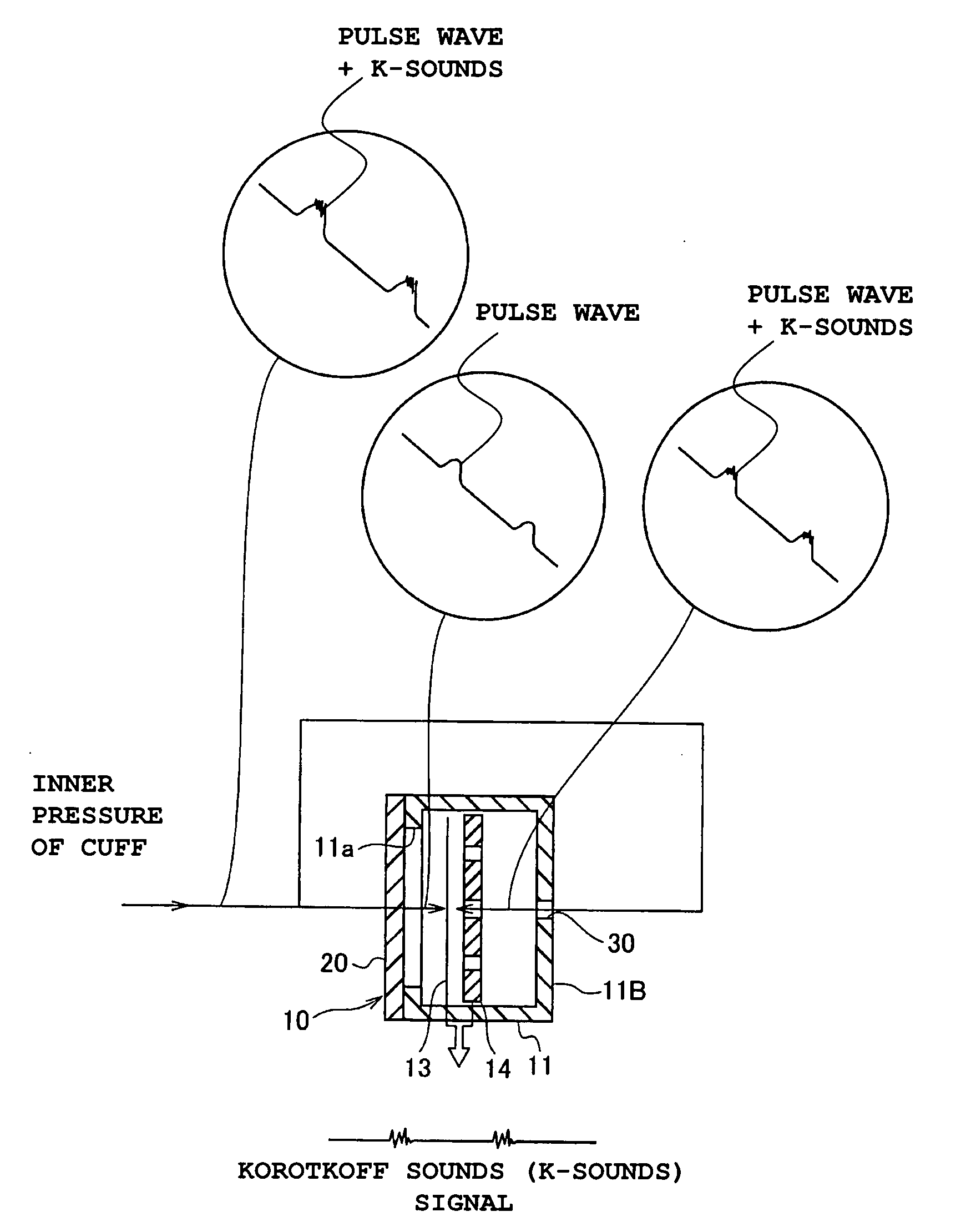 Condenser microphone, microphone unit, and blood pressure gauge