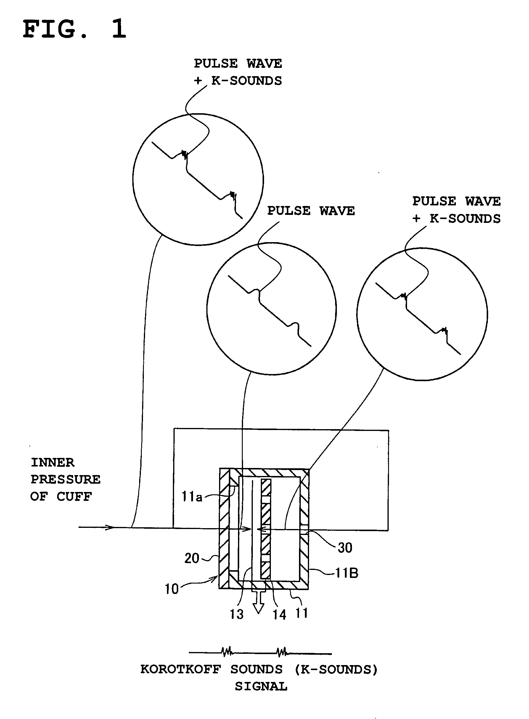 Condenser microphone, microphone unit, and blood pressure gauge