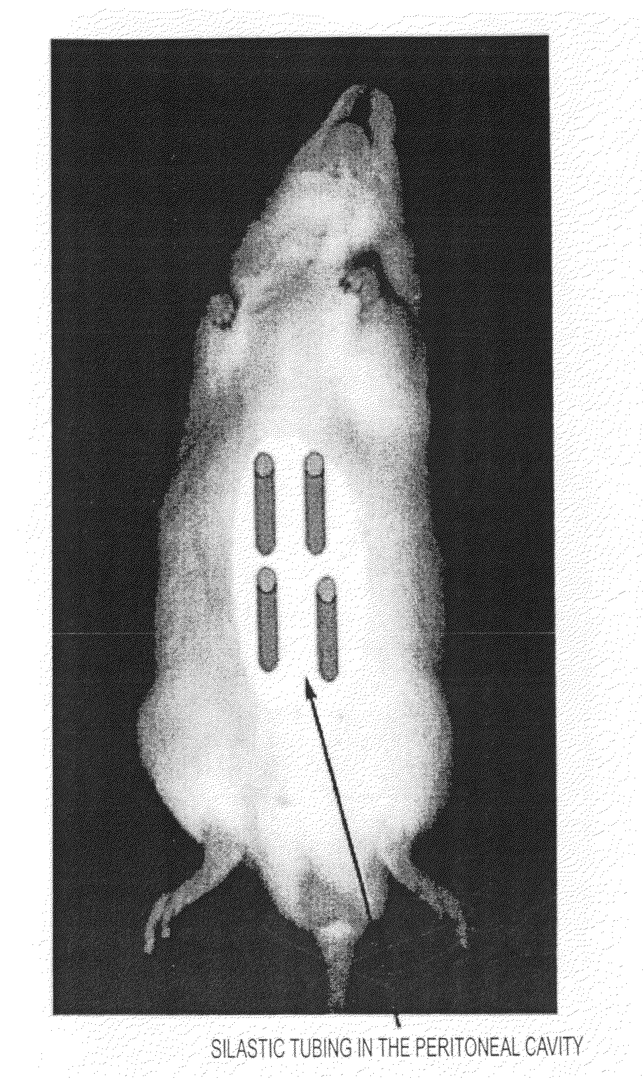 Method of producing tissue by placing a molding support within a body cavity