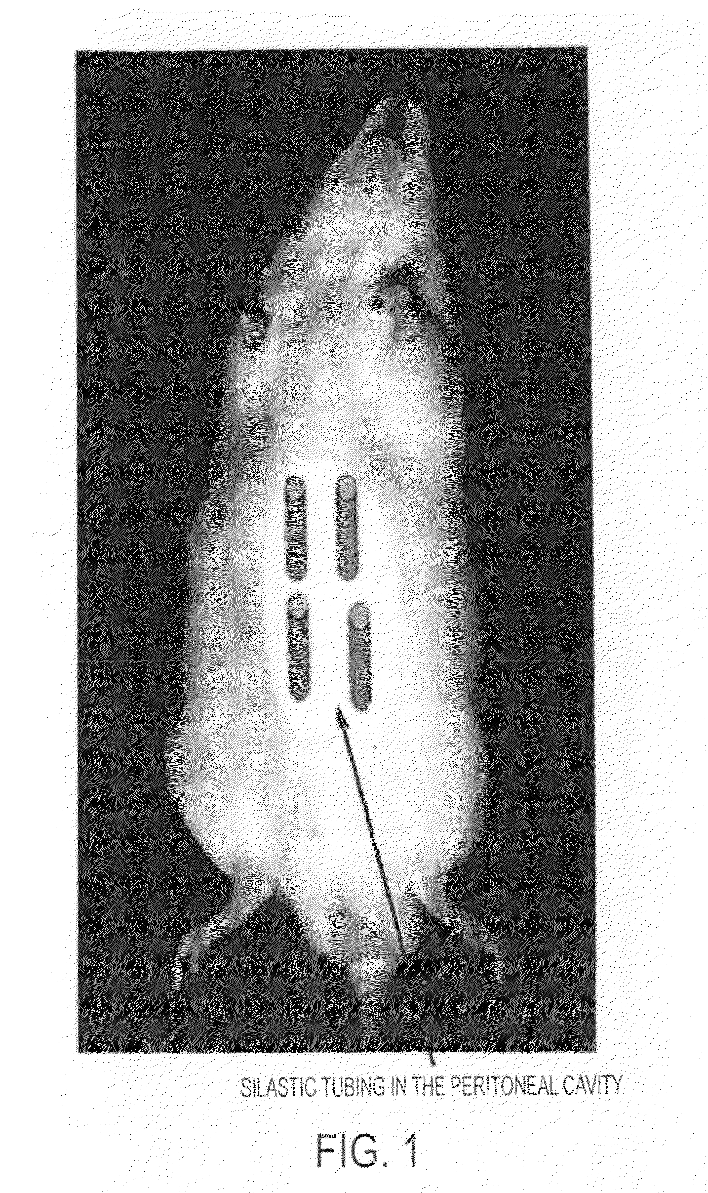 Method of producing tissue by placing a molding support within a body cavity