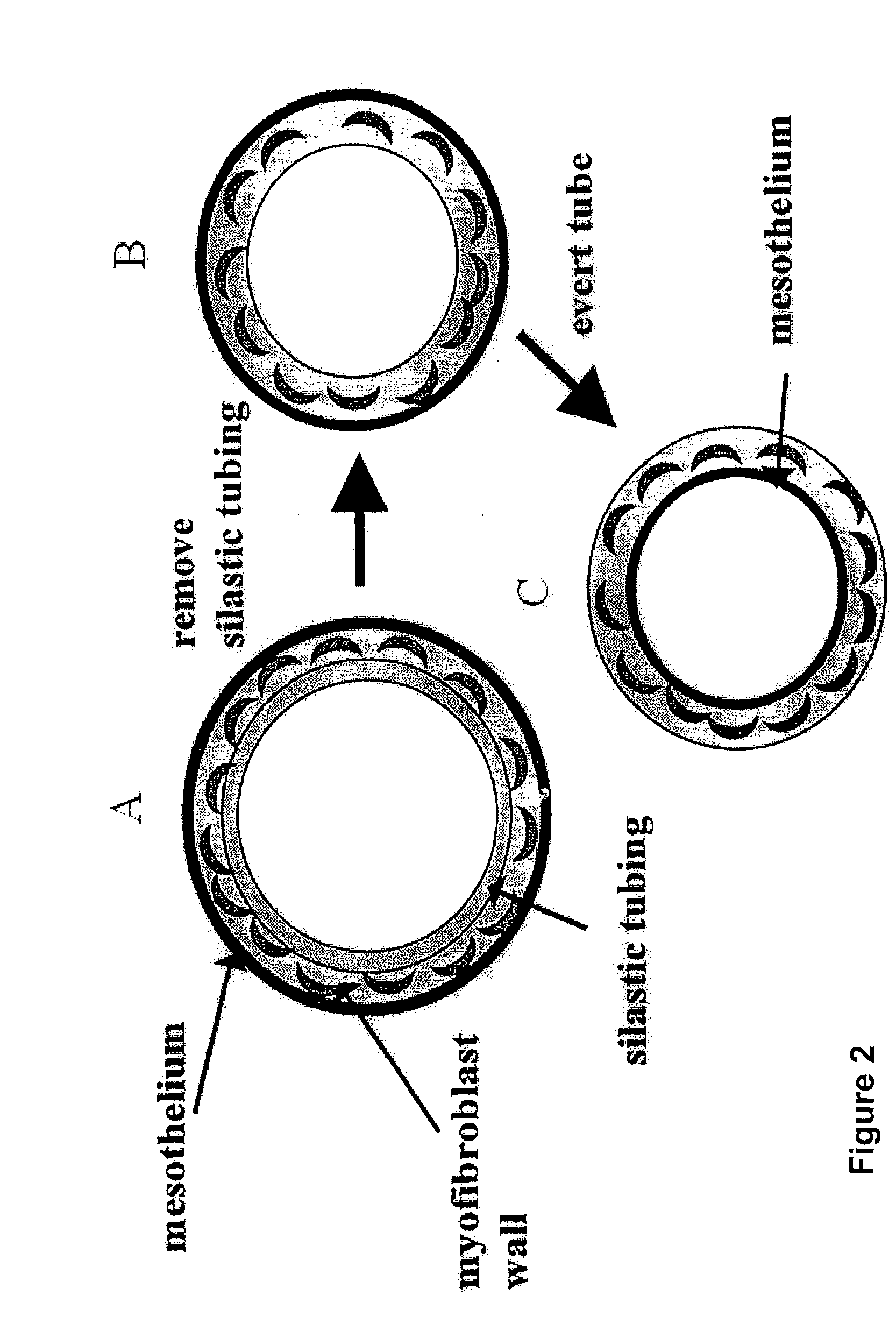 Method of producing tissue by placing a molding support within a body cavity