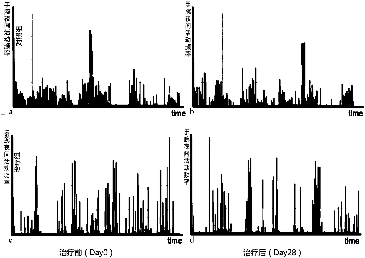 A Chinese medicinal composition for treating senile skin pruritus, and a preparation method and application thereof