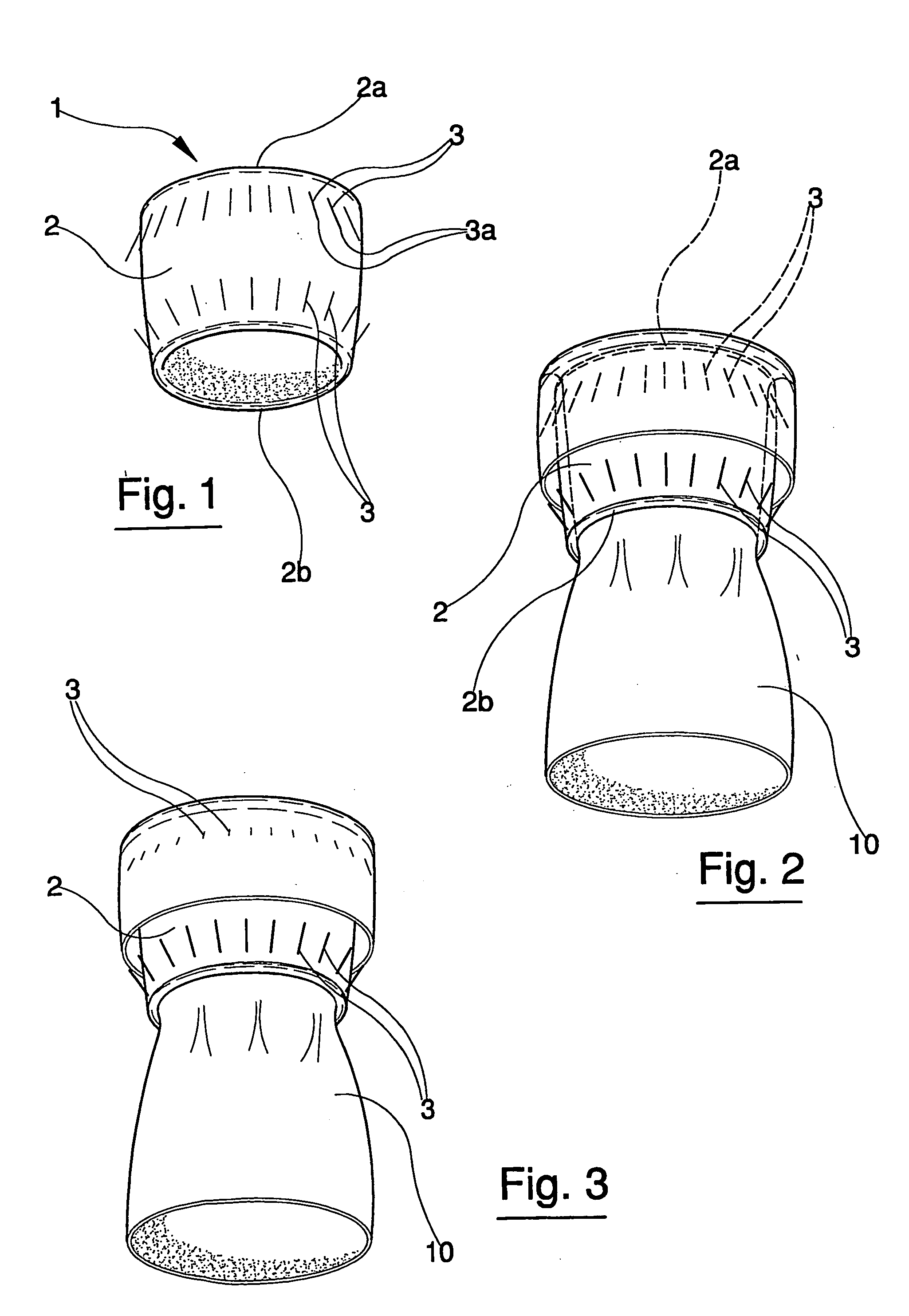 Device for anastomosis