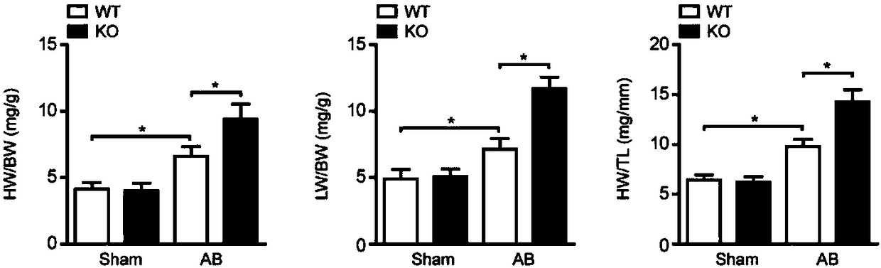 Application of leukocyte immunoglobulin like receptor B4 (LILRB4) to preparation of medicine for preventing, alleviating and/or treating cardiac hypertrophy