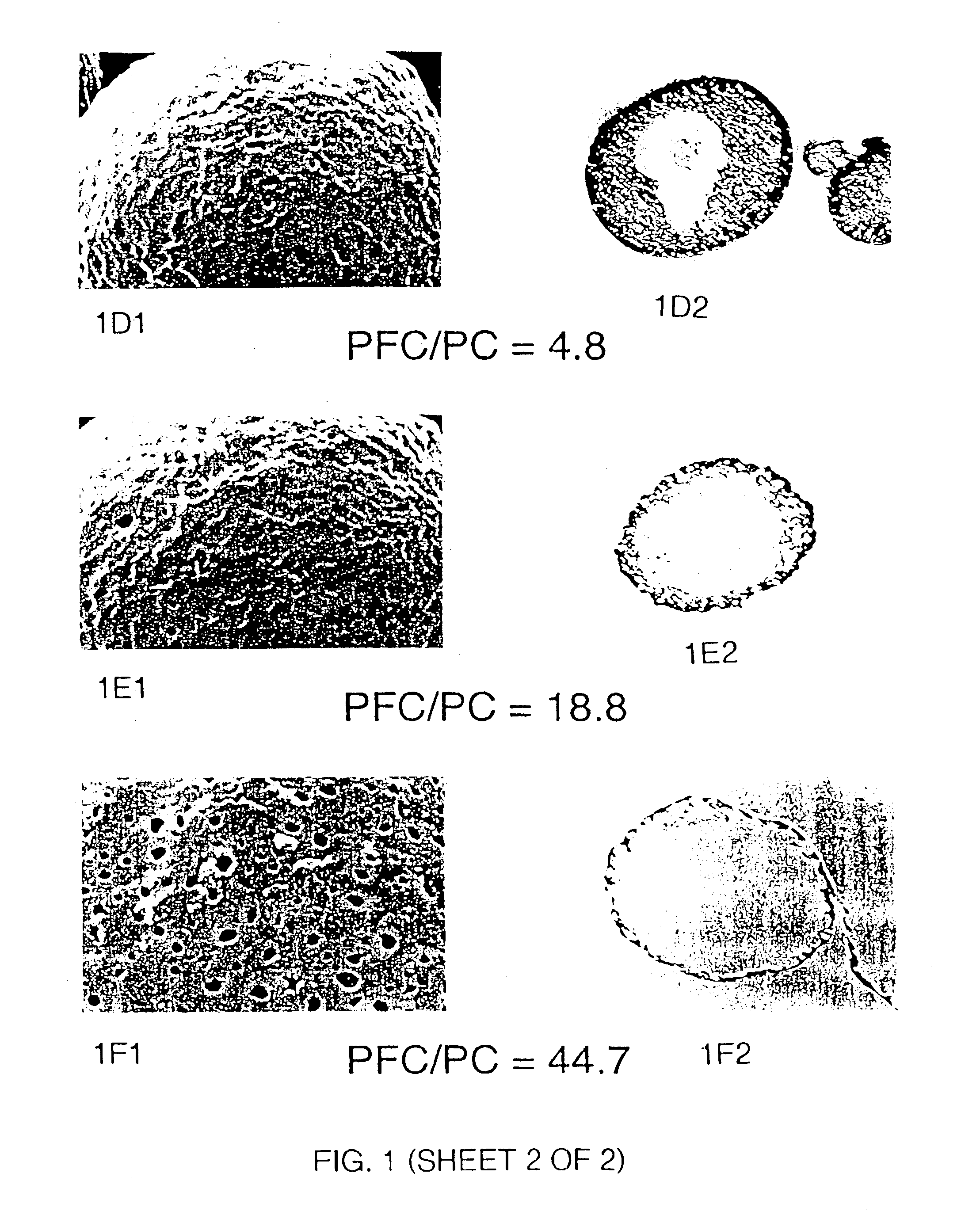 Stabilized preparations for use in nebulizers