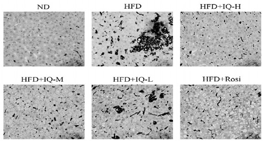 Application of isoquercetin in treatment of steatohepatitis