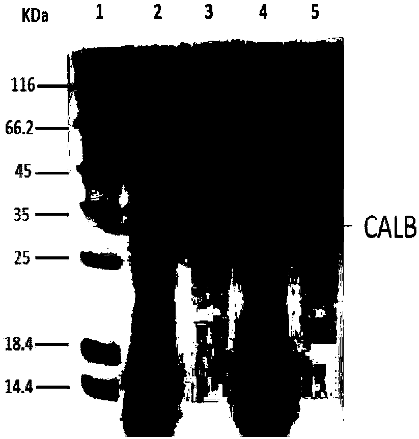 Recombinant lipase mutant, engineering bacteria and application of recombinant lipase mutant