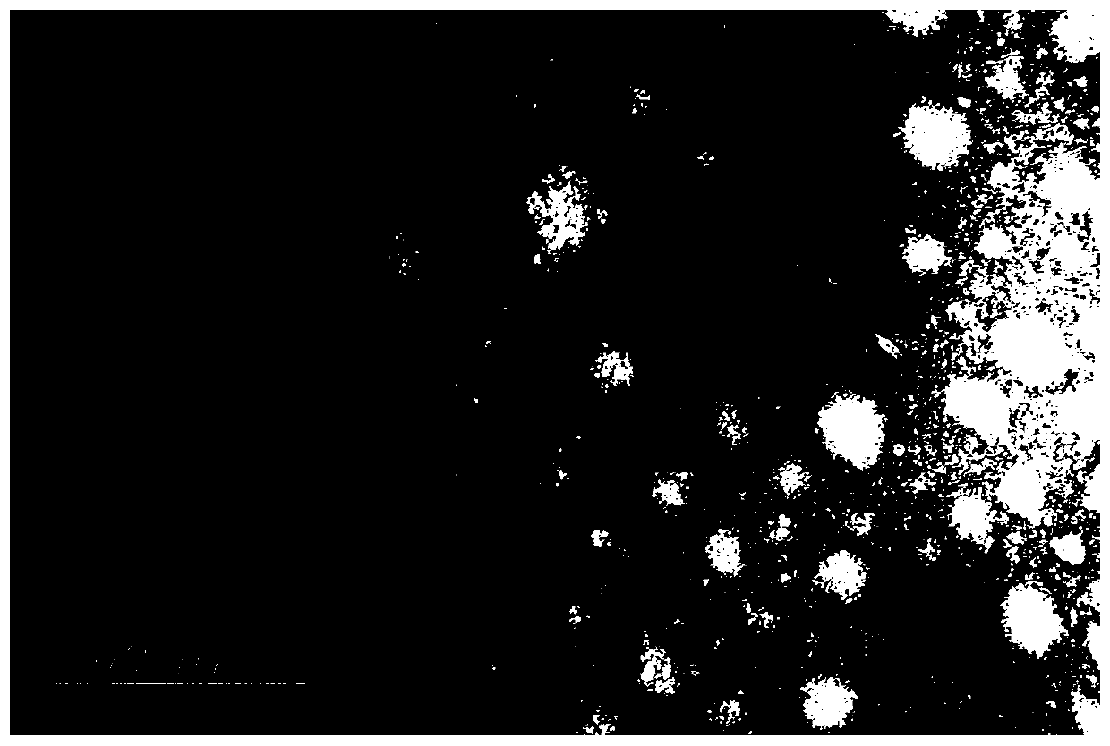 Preparation method of bacteriophage transmission electron microscope specimen