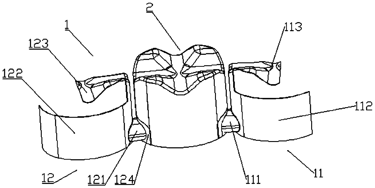 Fixed prosthesis for partially missing teeth and manufacturing method of fixed prosthesis