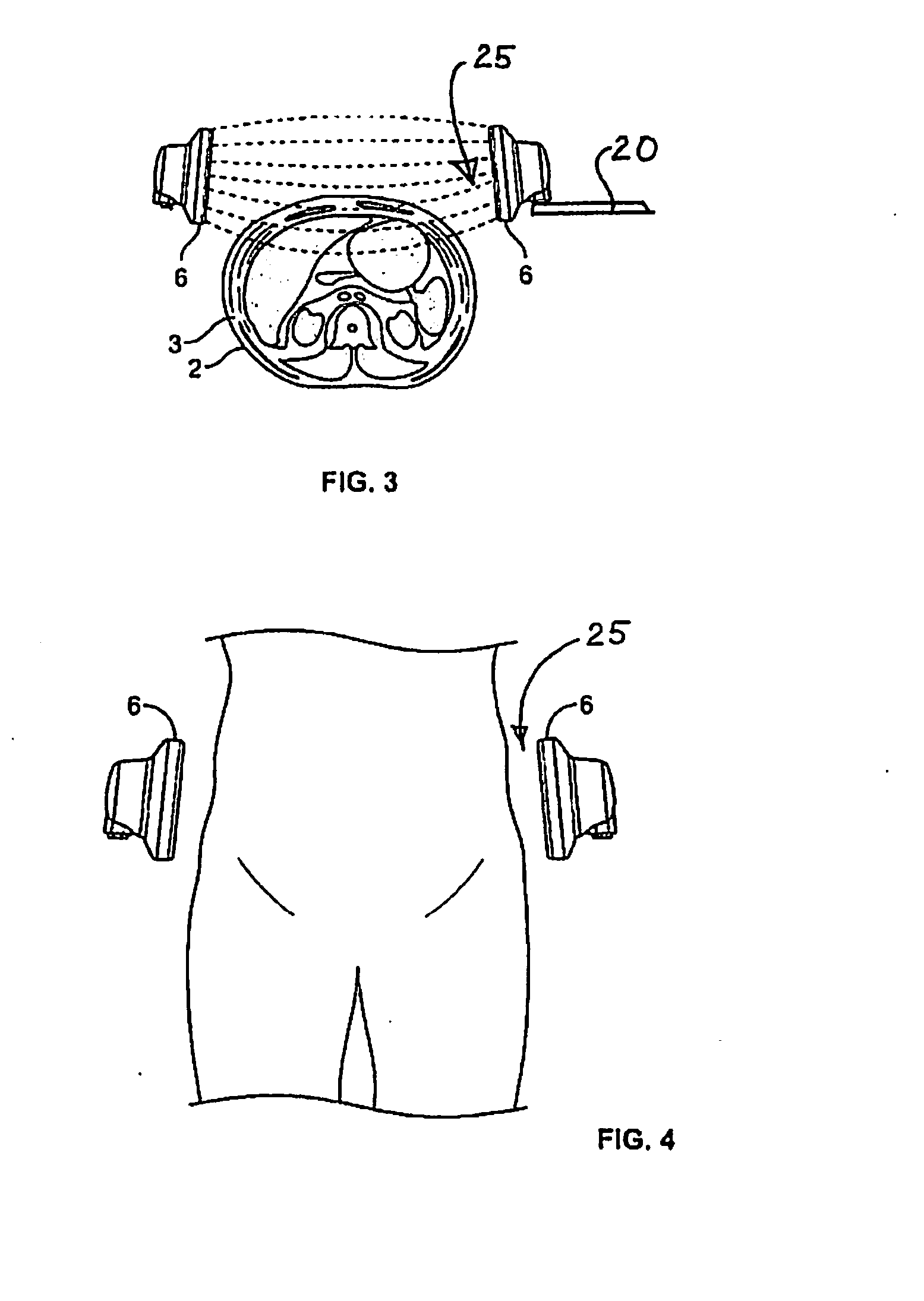 Methods and systems for skin treatment