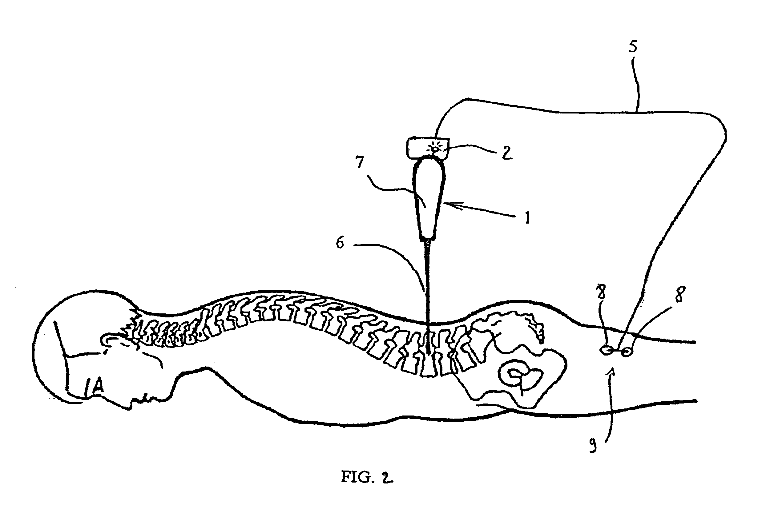 Method for drilling bone, in particular for setting a pedicle screw, equipment, instrument and control device for implementing said method