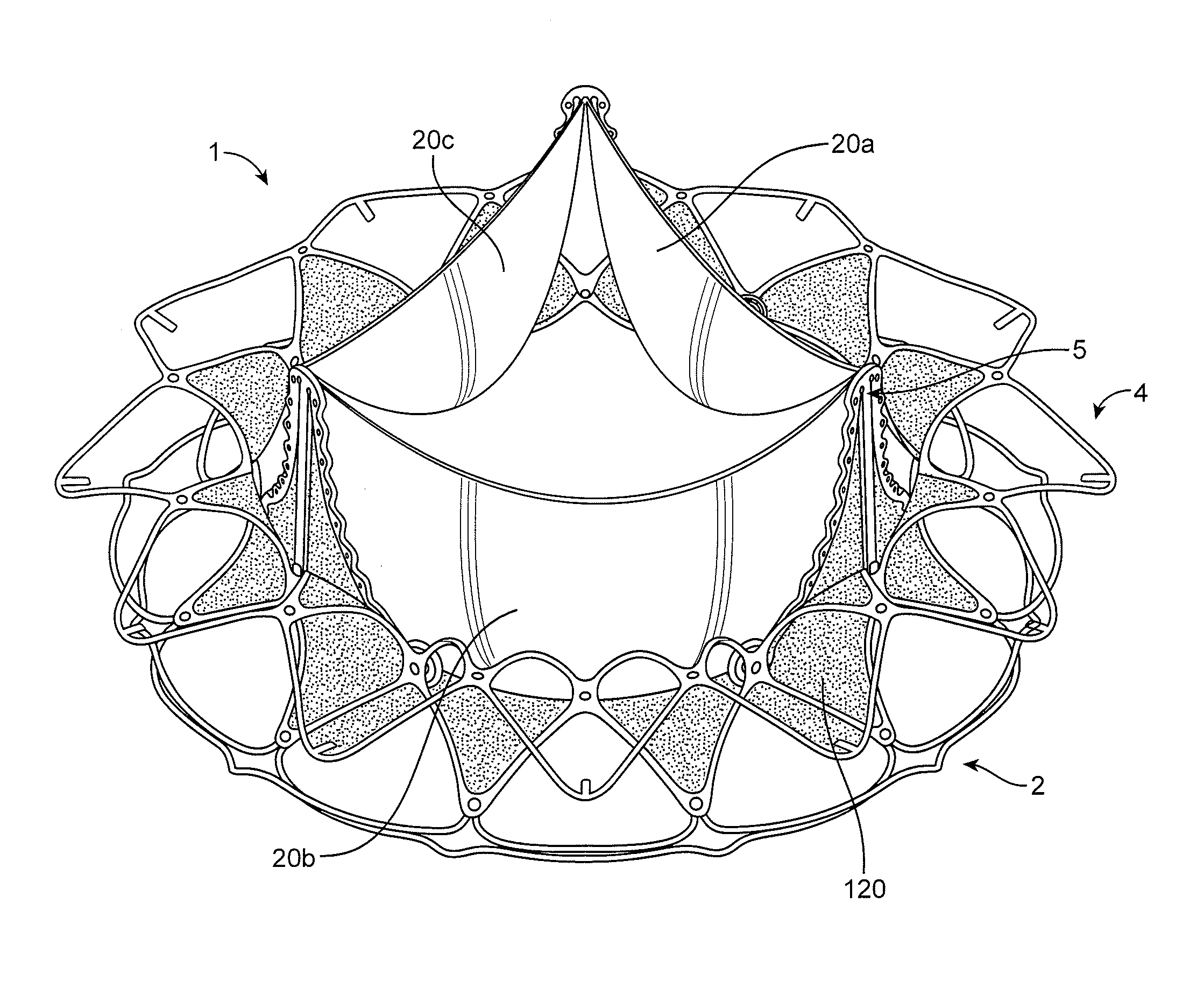 Replacement cardiac valves and methods of use and manufacture