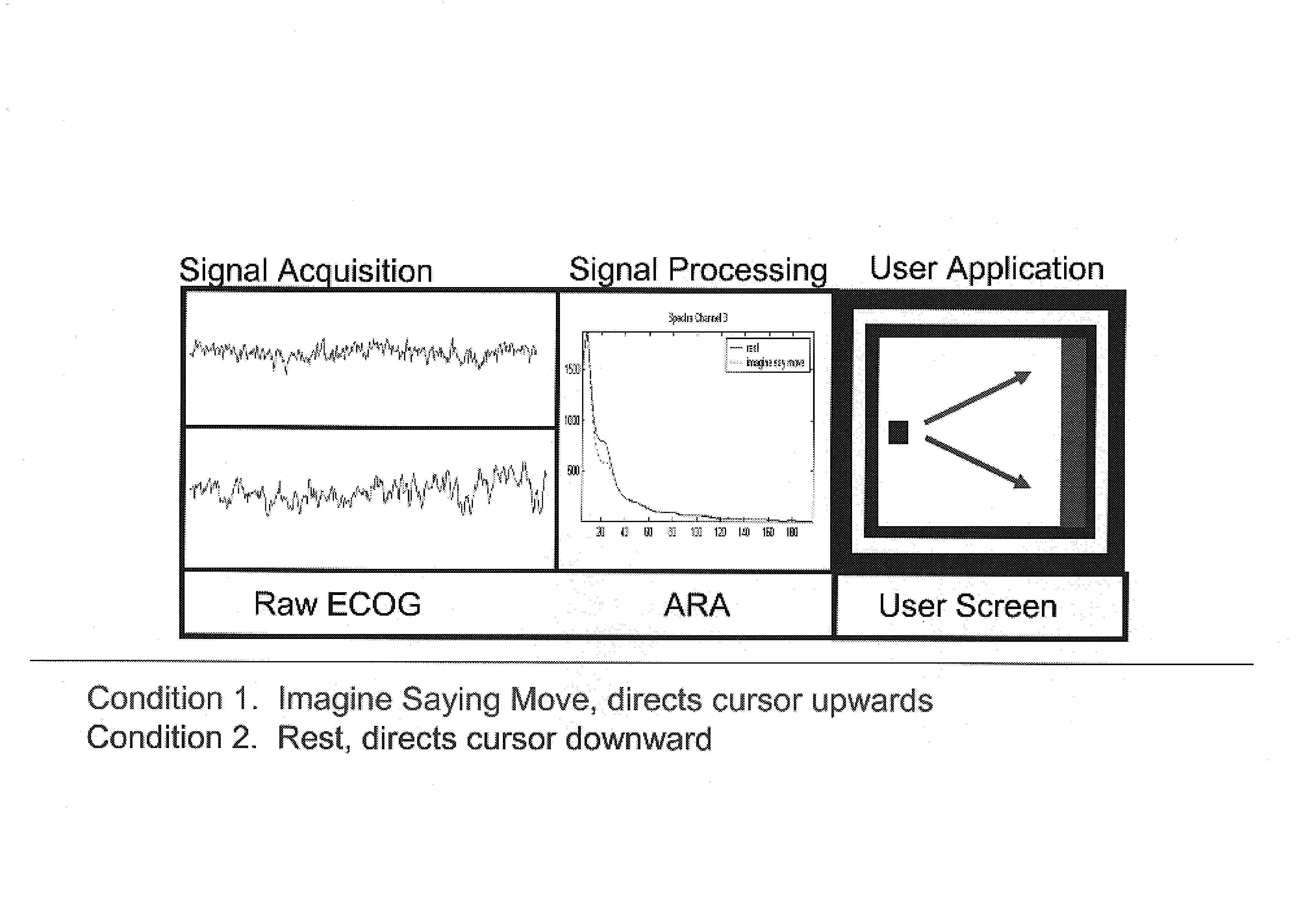 Brain computer interface