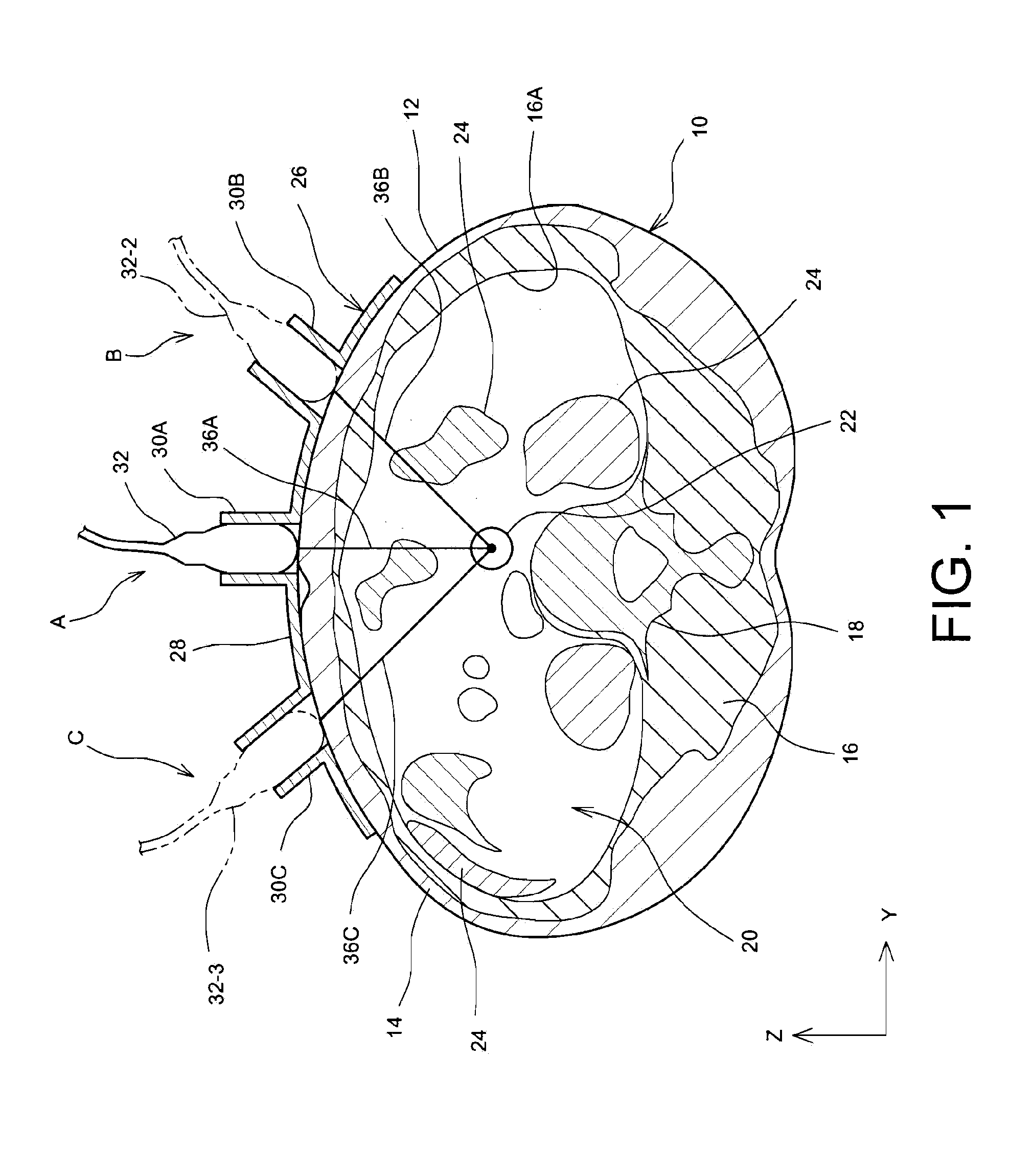 Ultrasonic diagnostic system