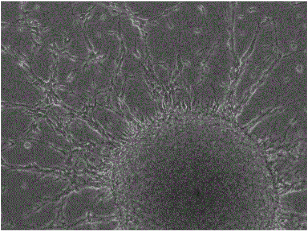 Neural stem cells medium and method for performing human neural stem cells in-vitro long-term culture and amplification by using neural stem cells medium