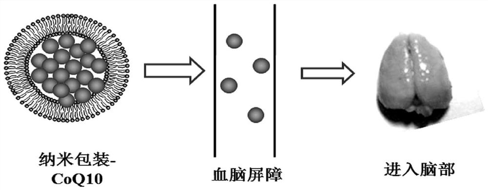 A composition for treating senile dementia, its preparation method and application