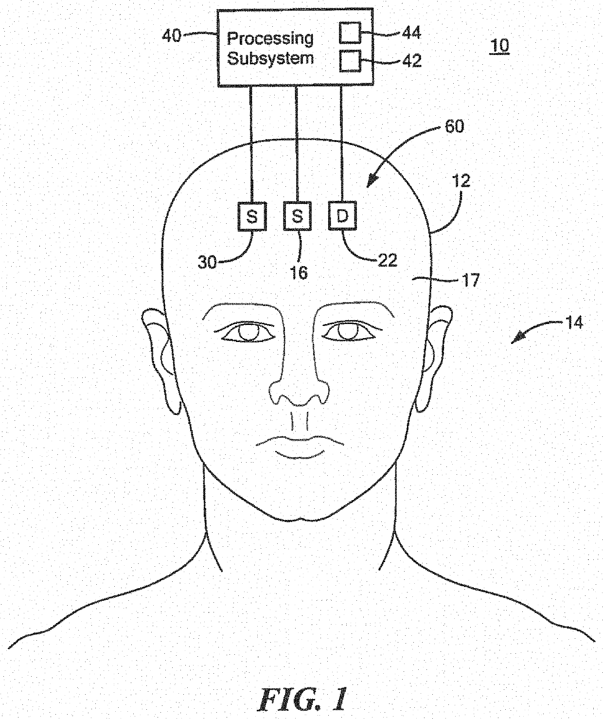 System and method for non-invasively measuring blood volume oscillations inside the cranium of a human subject and determining intracranial pressure