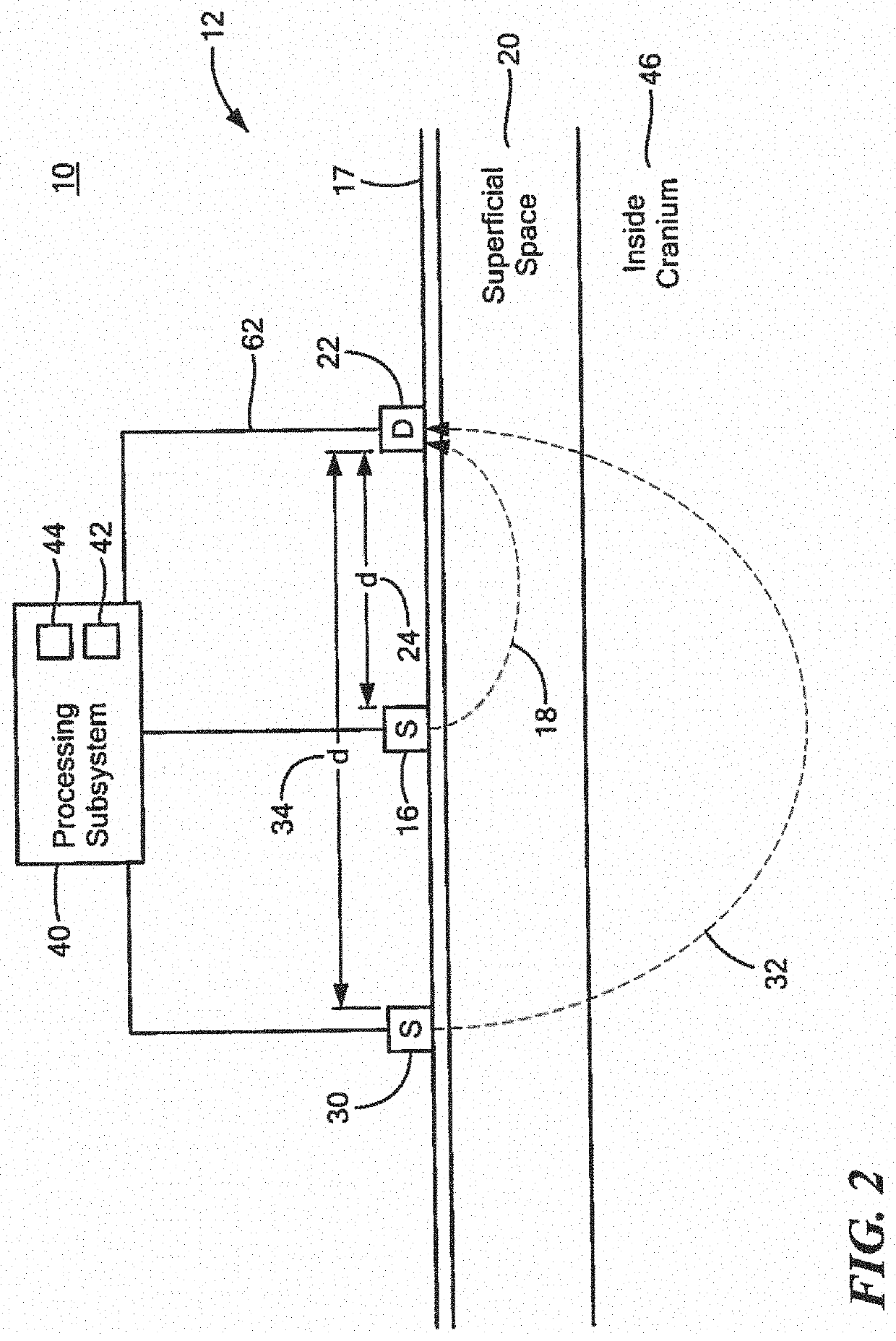 System and method for non-invasively measuring blood volume oscillations inside the cranium of a human subject and determining intracranial pressure