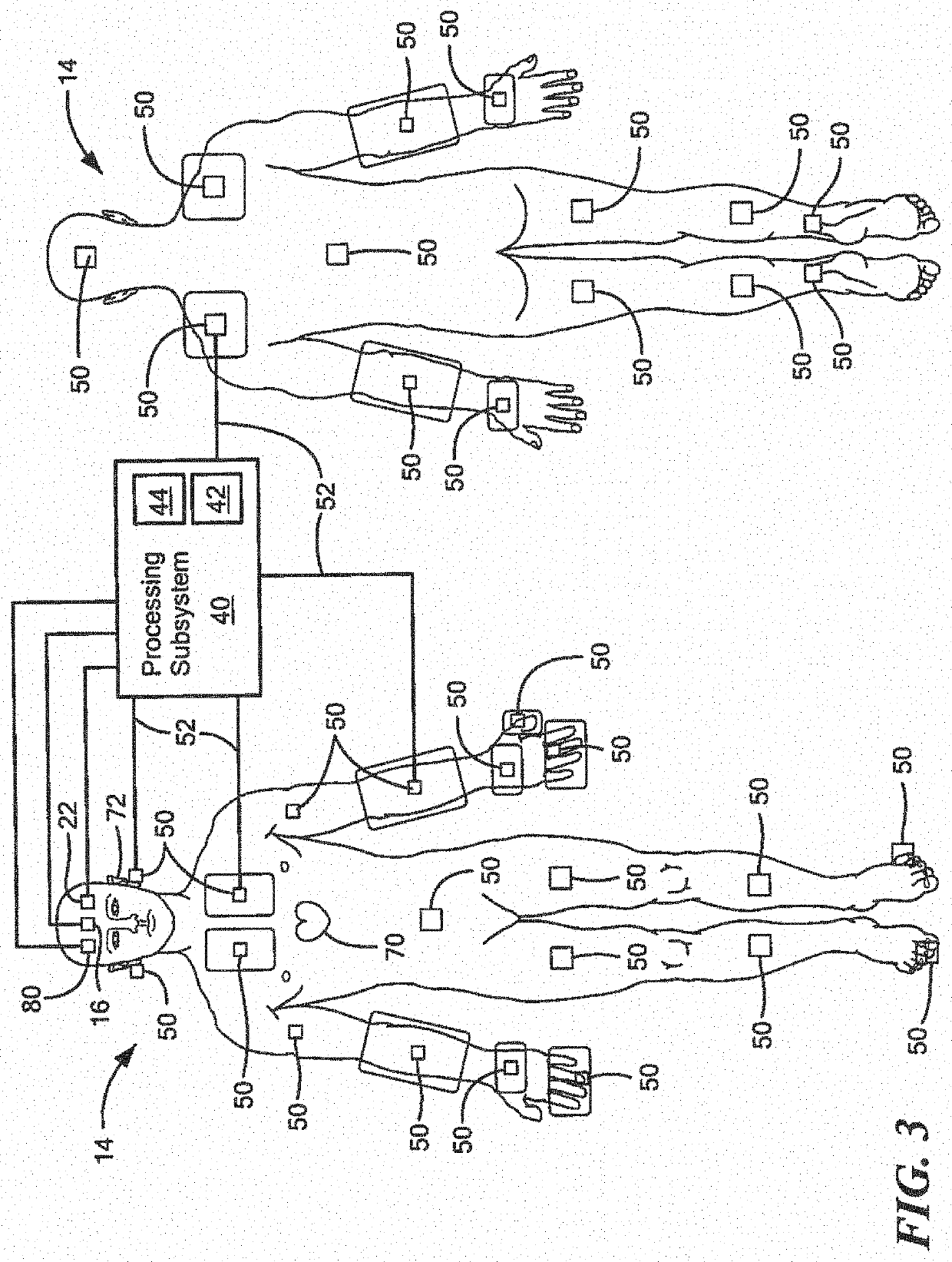 System and method for non-invasively measuring blood volume oscillations inside the cranium of a human subject and determining intracranial pressure