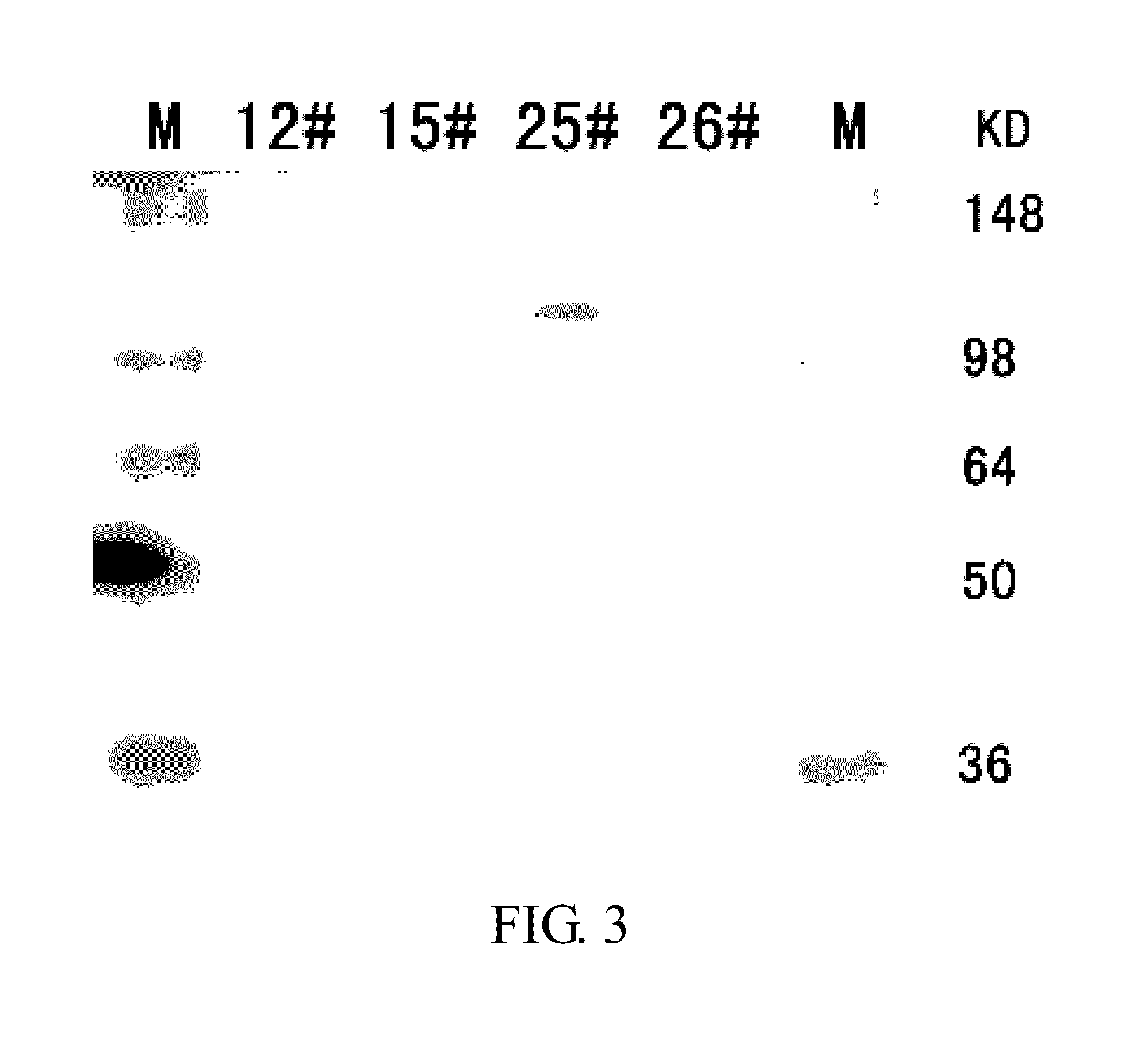 Fusion protein for antagonizing angiogenesis inducible factors and uses thereof