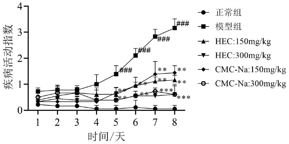 Application of cellulose derivative in preparation of medicine for treating ulcerative colitis