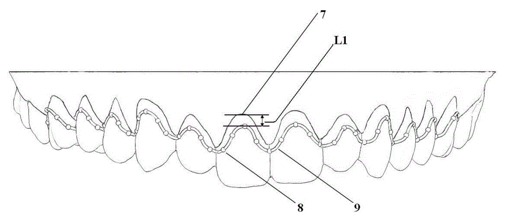 Computer-aided-design individual arch bar and manufacturing method thereof