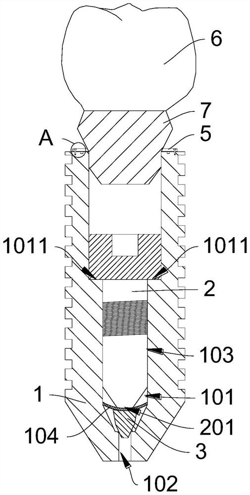 Oral implant and oral implant assembly