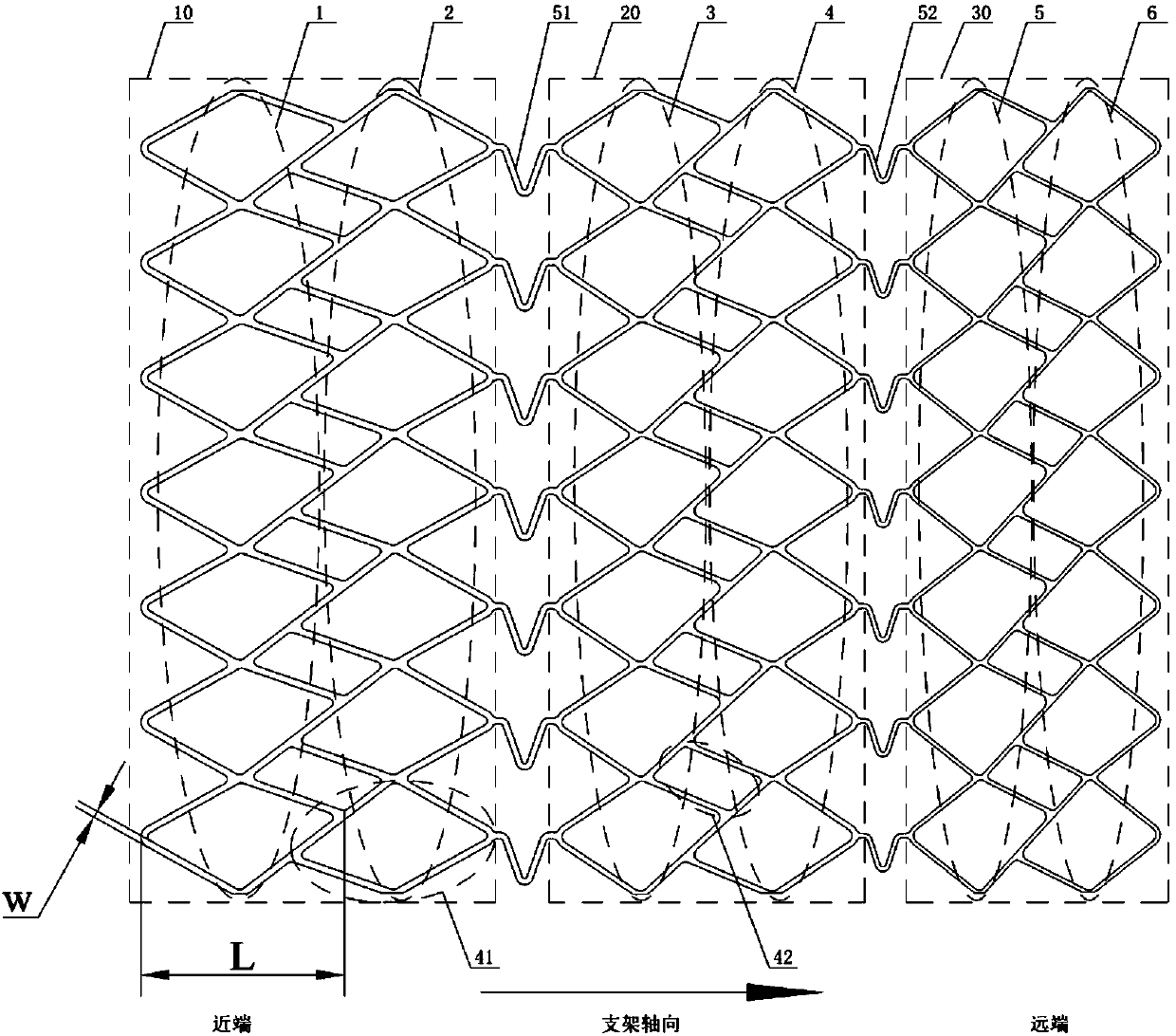 A stepped stent suitable for tapered vessels