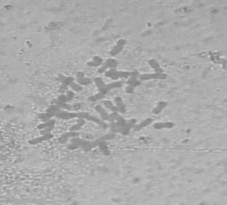 Micro-dissection method for exogenous chromosomes in trititrigia alien substitution line