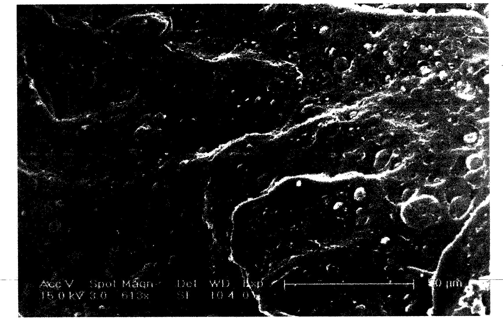 Surface modification method of bio-absorbable material implanted in polyester