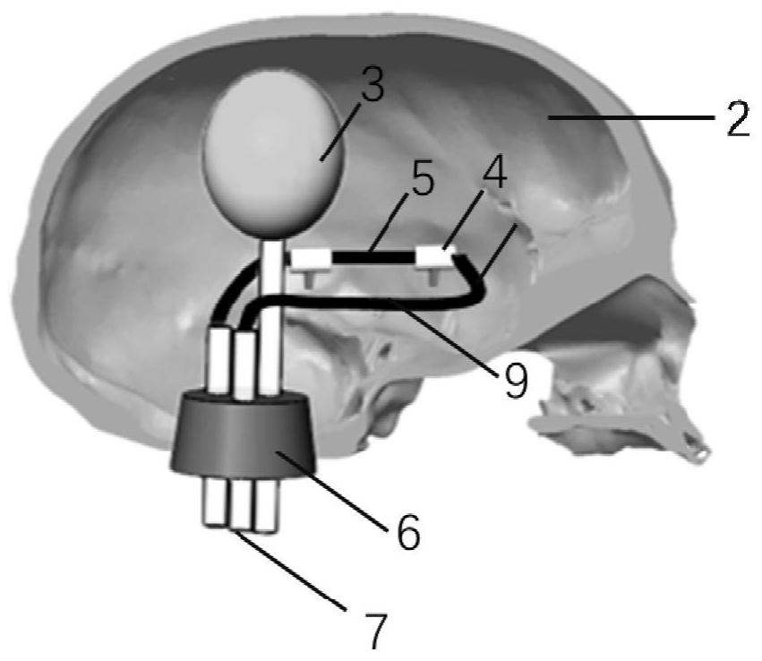 SonoVue-based non-invasive transcranial ultrasonic blood pressure measuring device and method