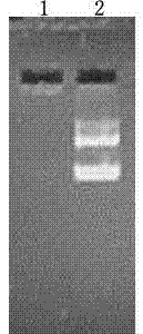 Application of chylomicron as liver targeting gene treatment vector