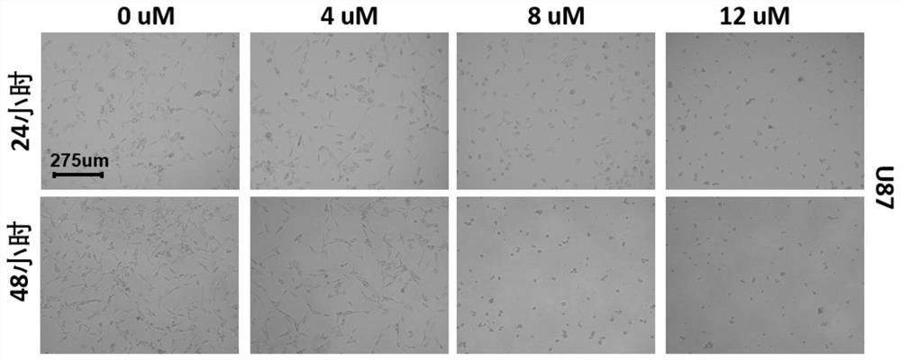 Application of sinomenine compound to preparation of medicines for preventing or treating glioma