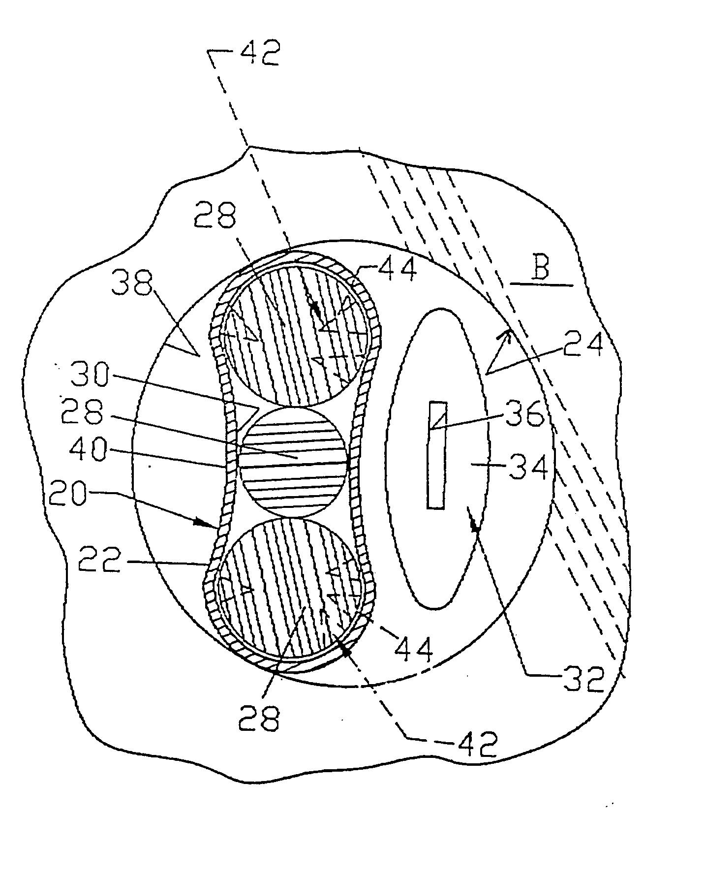 Graft ligament anchor and method for attaching a graft ligament to a bone