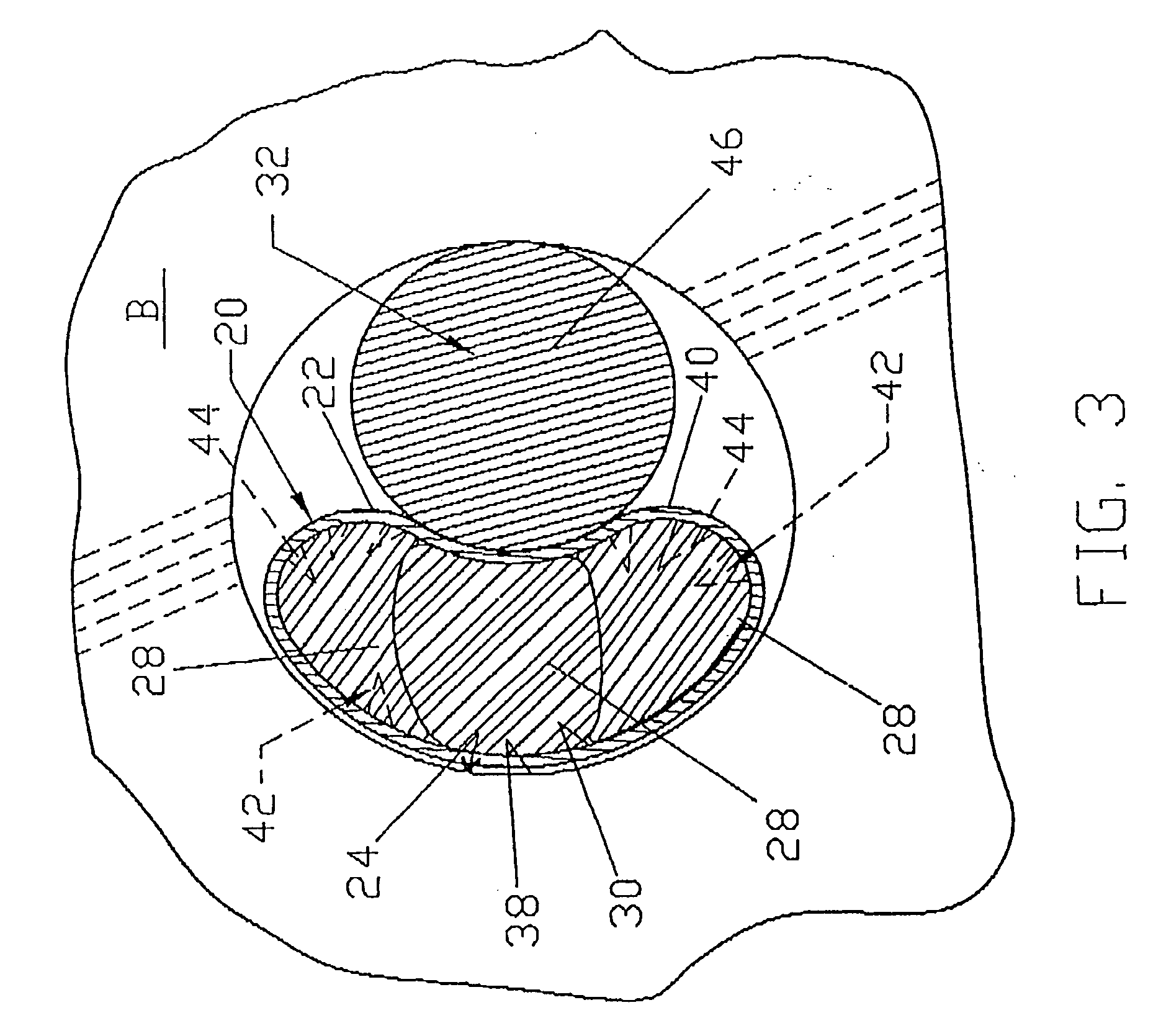 Graft ligament anchor and method for attaching a graft ligament to a bone