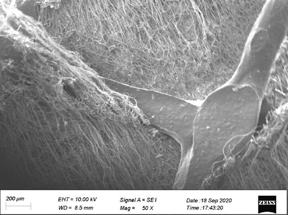 Polylactic acid elastic non-woven material beneficial to tissue regeneration and preparation method thereof