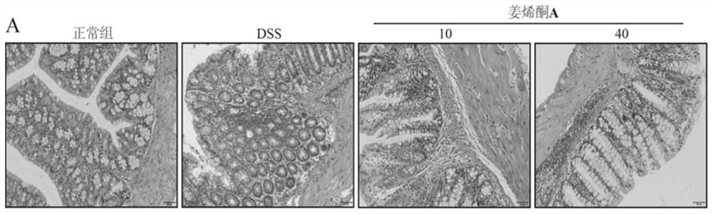 Application of zingerenone a in the preparation of drugs for preventing and treating colitis