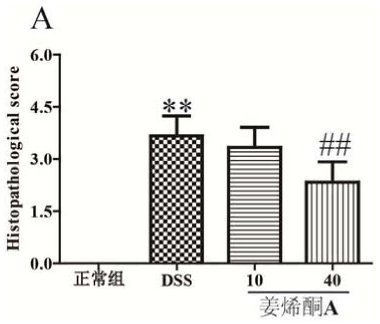 Application of zingerenone a in the preparation of drugs for preventing and treating colitis