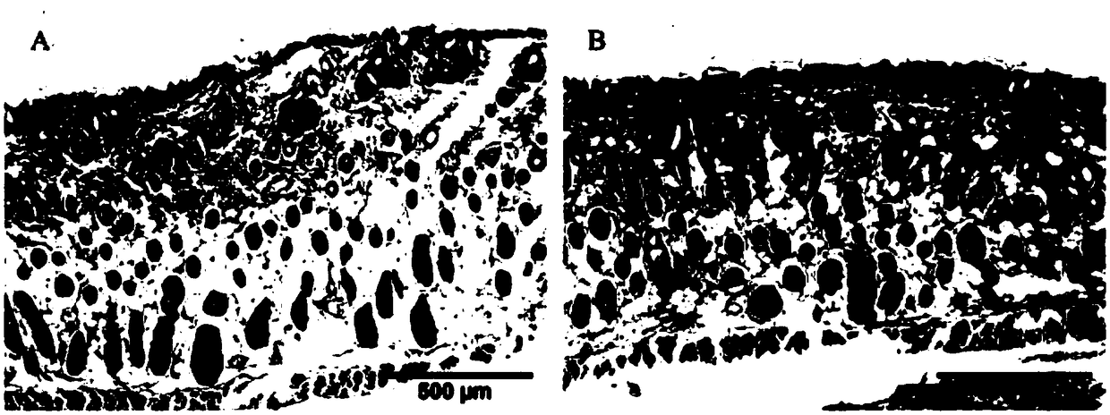 Preparation method and application of earthworm supernatant protein nano collagen repair compound