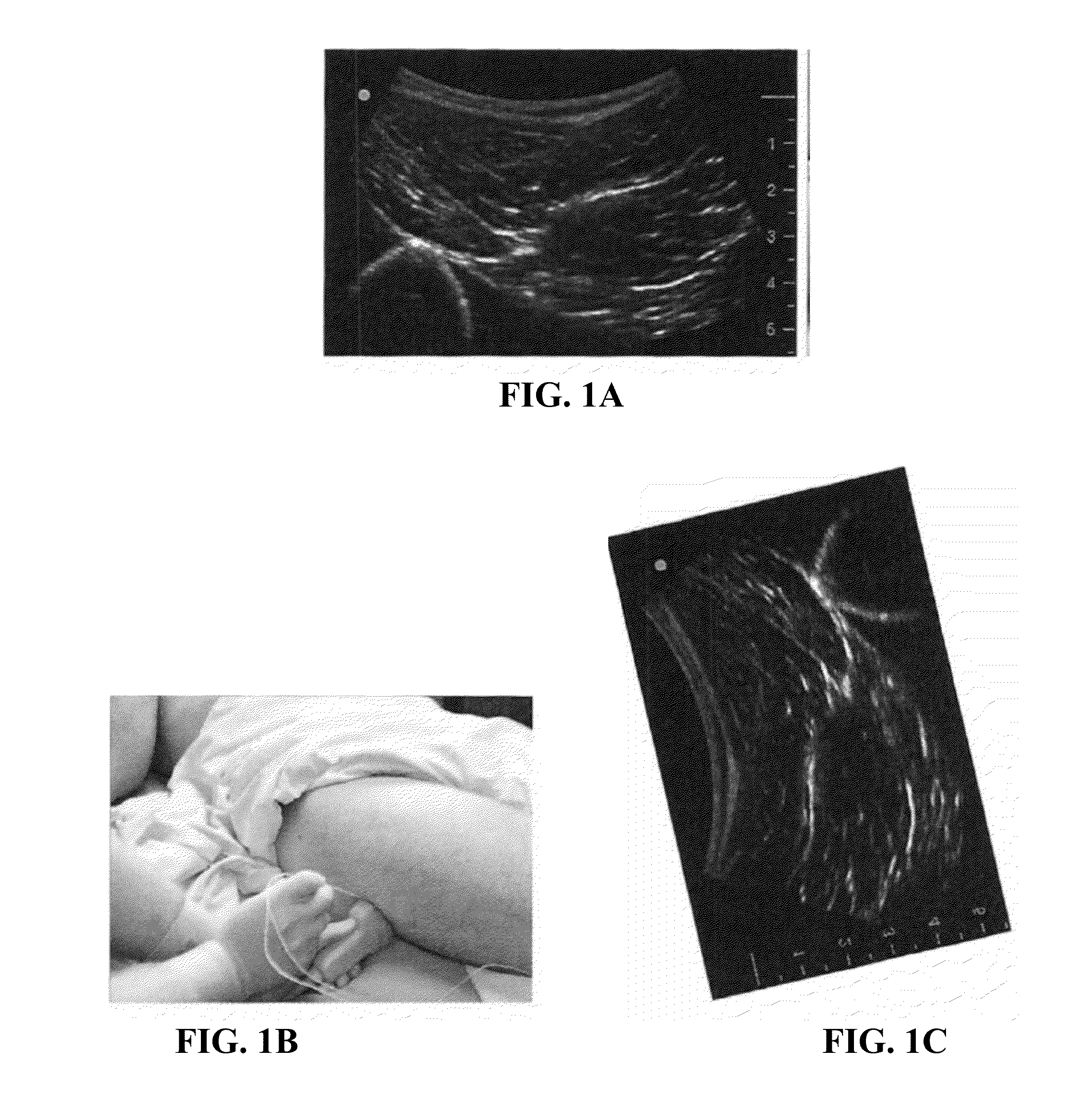 Enhanced ultrasound imaging interpretation and navigation