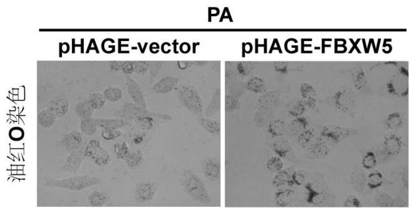 Application of fbxw5 and its inhibitors in the preparation of drugs for the treatment of fatty liver and related diseases