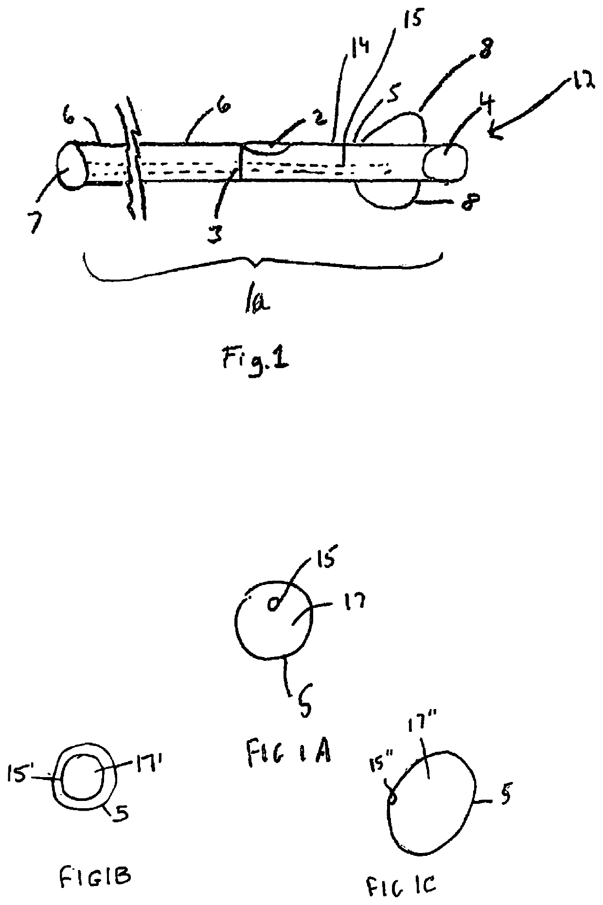 Bypass catheter