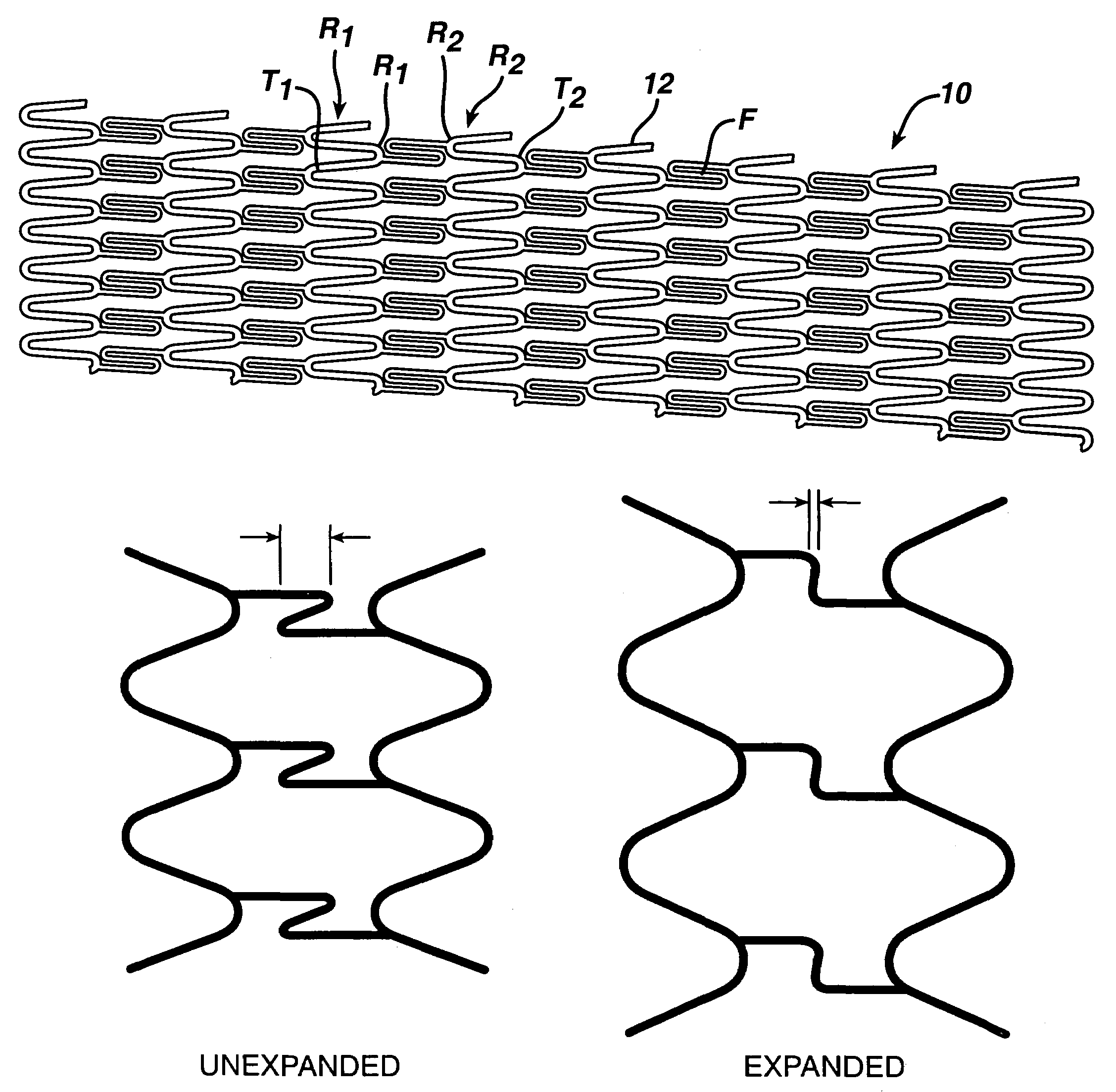 Stent with enhanced crossability